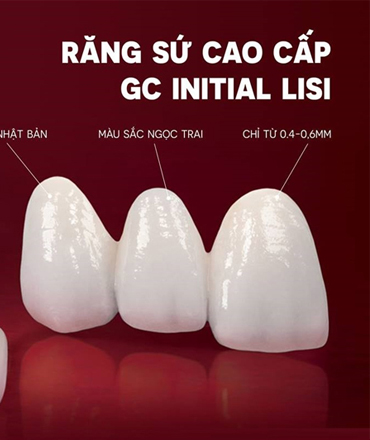 Răng sứ Lisi